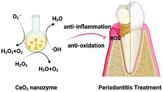 Graphical abstract: Cerium oxide nanozyme attenuates periodontal bone destruction by inhibiting the ROS–NFκB pathway