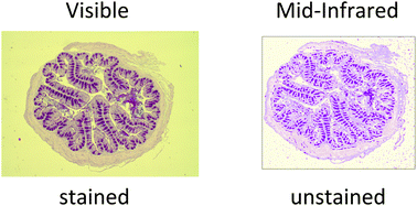 Graphical abstract: Rapid identification of goblet cells in unstained colon thin sections by means of quantum cascade laser-based infrared microspectroscopy