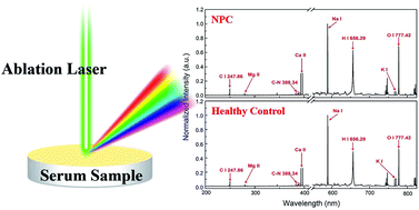 Graphical abstract: Discrimination of nasopharyngeal carcinoma serum using laser-induced breakdown spectroscopy combined with an extreme learning machine and random forest method