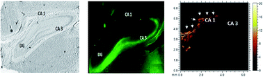 Graphical abstract: Mass spectrometry imaging as a novel approach to measure hippocampal zinc