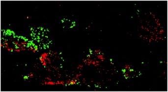 Graphical abstract: Elemental bioimaging and speciation analysis for the investigation of Wilson's disease using μXRF and XANES