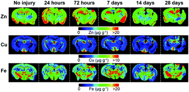 Graphical abstract: Age modulates the injury-induced metallomic profile in the brain