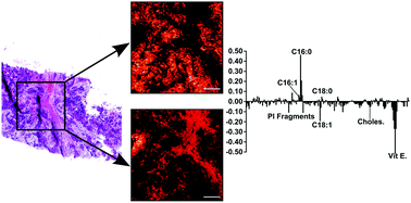Graphical abstract: An unsupervised MVA method to compare specific regions in human breast tumor tissue samples using ToF-SIMS