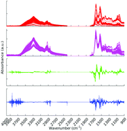 Graphical abstract: Combining random forest and 2D correlation analysis to identify serum spectral signatures for neuro-oncology