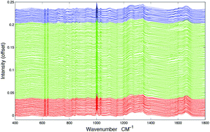 Graphical abstract: Feature driven classification of Raman spectra for real-time spectral brain tumour diagnosis using sound