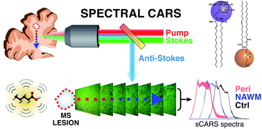 Graphical abstract: Lipid biochemical changes detected in normal appearing white matter of chronic multiple sclerosis by spectral coherent Raman imaging