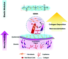 Graphical abstract: Zwitterionic poly(sulfobetaine methacrylate) hydrogels with optimal mechanical properties for improving wound healing in vivo