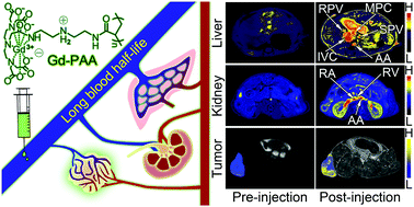 Graphical abstract: An MRI contrast agent based on a zwitterionic metal-chelating polymer for hepatorenal angiography and tumor imaging