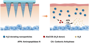 Graphical abstract: Microneedle-mediated transdermal H2S gas therapy for psoriasis