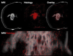 Graphical abstract: Ultra-high resolution magnetic resonance microscopy of in situ gadolinium gold nanoparticle-labeled cells in the rat brain