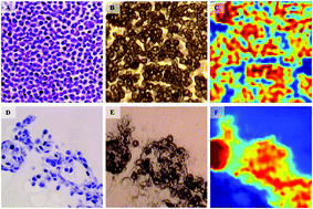 Graphical abstract: Infrared imaging of MDA-MB-231 breast cancer cell line phenotypes in 2D and 3D cultures