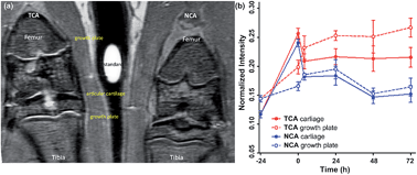 Graphical abstract: In vivo visualization of osteoarthritic hypertrophic lesions