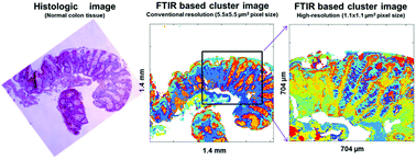 Graphical abstract: Prospective on using fibre mid-infrared supercontinuum laser sources for in vivo spectral discrimination of disease