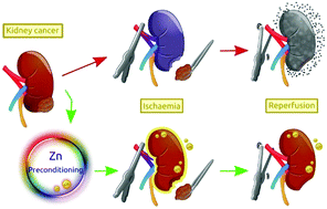 Graphical abstract: Why is it worth testing the ability of zinc to protect against ischaemia reperfusion injury for human application