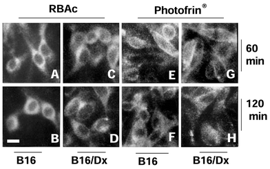 Typical fluorescence distribution patterns of RB (A–D) and porphyrin (E–H) in B16 (A, B, E, F) and B16/Dx cells (C, D, G, H) incubated with 5 × 10−6 M RBAc or 5 μg ml−1 Photofrin® for 60 min (A, C, E, G) and 120 min (B, D, F, H). Exc.: 500 nm interference filter, em. > 540 nm (RB); exc.: 405 nm interference filter, em. > 600 nm (Photofrin®). The sensitivity of the camera was adjusted according to the fluorescence signal. Scale bar represents 14 μm.