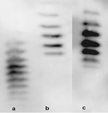 Western blots of (a) normal urinary EPO, (b) recombinant EPO, and (c) EPO recovered from the urine of a subject after recombinant EPO injections (cathode top of gel and anode bottom of the gel).