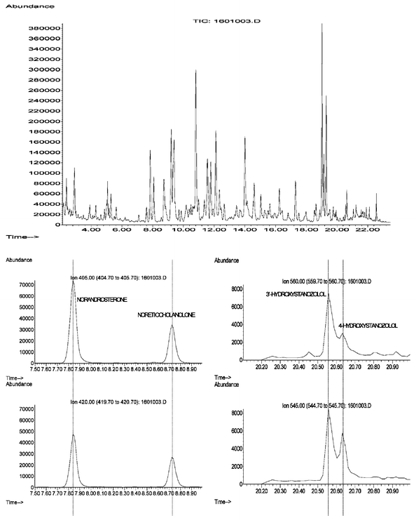 TIC (top) and ion chromatograms for 19-nortestosterone (nandrolone) metabolites, 19-norandrosterone and 19-noretiocholanolone (left) and for stanozolol metabolites 3′-hydroxystanozolol and 4β-hydroxystanozolol (right).