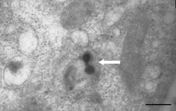 Micrograph depicting two CaCPP sensors in the cytoplasm of a CHO cell, indicated by the white arrow. The sensors were introduced to the cell during a 30 min incubation period, entering the cell using the CPP functionality attached to the outer sensor matrix (size bar = 100 nm).