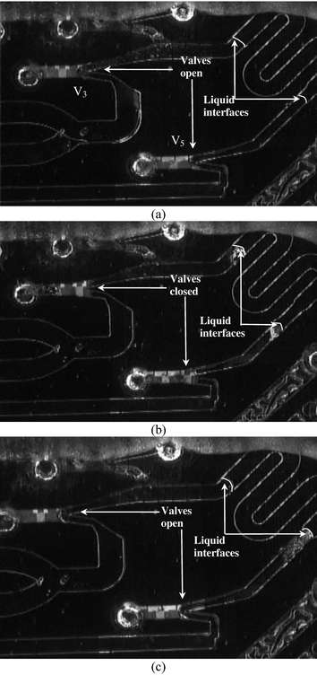 Valve integration with PCR chamber. (a) The reagent is positioned in the PCR chamber. (b) Valves V3 and V5 that flank the PCR chamber are closed (valve V4 is not used and is sealed with UV glue during device assembly). (c) Valves V3 and V5 are opened. Note that there is some evaporation of the reagents during valve operation that can be eliminated by using advanced thermal isolation schemes.