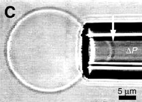 Aspiration of a polymer vesicle into a micropipette. The arrow marks the tip of a projection of a vesicle being sucked in by a negative pressure ΔP.3