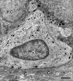 Transmission electron microscopy view of a melanocyte (MC) in the basal layer of the epidermis of human skin. Note the presence of fine melanin granules in the clear cytoplasm of a melanocyte, which is in close apposition to two keratinocytes (KC). One KC contains multiple transferred melanin granules. D, dermis; Col, collagen. Scale bar = 1.3 µM.