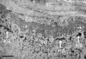 Transmission electron microscopy view of the upper epidermis of normal human skin showing the S. corneum (SC) and S. granulosum (SG). Note the presence of dark-staining keratohyalin granules (KG). Scale bar = 1 µM.