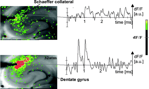 A fluorescent image of a rat hippocampal slice obtained using the VSD method at ambient pressure and 32 atm respectively in the high pressure cell. Still images of neuronal transient assembly formation on a Schaeffer collateral pathway of a rat hippocampal slice stained with VSD are shown. The overall image is 2 × 3 mm and each pixel provides an optical trace of differential fluorescence dF/F over time. The maximum dF/F signals are superimposed on the hippocampus image with the excitation electrode, The Schaeffer collateral and dentate gyrus are easily recognised on the slice. The amplitude of the optical signal represented in pseudo-colours indicates the degree of membrane depolarisation. Two electrical pulses of amplitude 60 V lasting 0.1 ms each, separated from each other by 60 ms, triggered spreading of the neuronal signal within the brain slice. The depolarisation started at the stimulating electrode, with the first excitation pulse occurring 100 ms after starting the measurement, and spread along the CA3–CA1 Schaeffer collateral pathway. Under hyperbaric conditions (P = 32 atm), the neuronal voltage response is much stronger, and the signal propagation along the CA3–CA1 Schaeffer collateral is considerably extended.