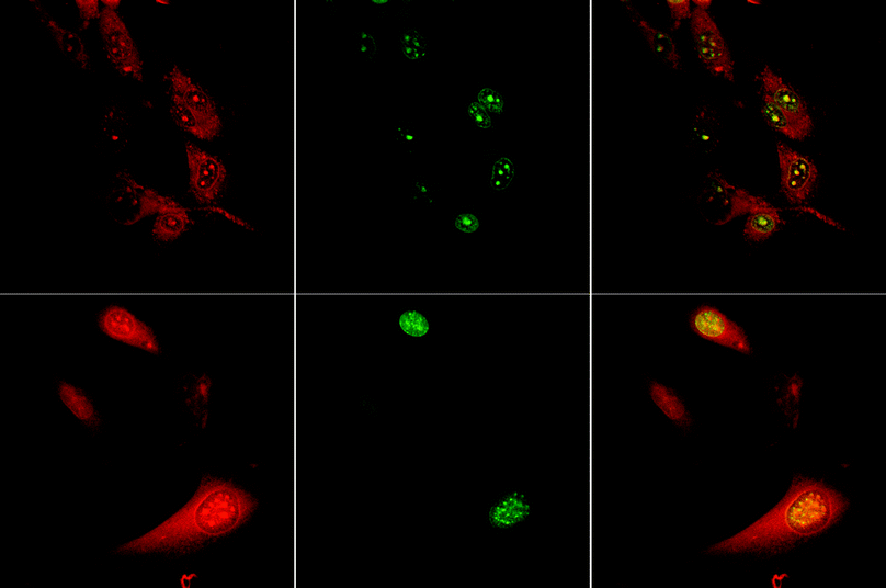 Confocal fluorescence microscopy study showing the cellular localisation behaviour of the europium complex 2 (λexc 405 nm) in living (upper row) and fixed (lower) cells, revealing the staining of the nucleolus inside the cell nucleus, consistent with the observed co-localisation of the green fluorescent dye ‘SYTO-RNA-select’.