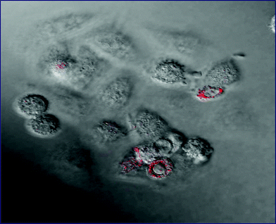 Combined confocal fluorescence and DIC images of HeLa cells following incubation with phthalocyanine-nanoparticle conjugates. The presence of the nanoparticle conjugates within the HeLa cells can be readily seen from the fluorescence emission (red) following excitation at 633 nm.