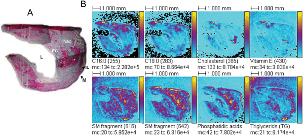 
          TOF-SIMS images in a non-calcified endartery sample. (A) Masson's stained slice consecutive to the one used for TOF-SIMS analysis, showing major morphological features: L (arterial lumen), Neo (atherosclerotic intima), M (medial fragments), IL (internal elastic lamina), FC (fibrous cap); (B) Eight of the most intense peaks found in the same sample are represented as bidimensional ion density maps. The field of view is 8.4 × 8.4 mm2 (256 × 256 pixels). To increase the contrast, the images are compressed to 128 × 128 pixels (final spatial resolution 65.6 µm). The primary ion dose density is about 5 × 109 ions cm–2. The name of the compounds and the m/z value of the peak centroid, the maximal number of counts in a pixel (mc) and the total number of counts (tc) are written below each image. The color scales correspond to the interval [0, mc].