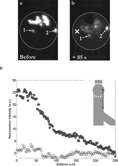 Probing the poration of HL60 cells upon their exposure to a single cavitation bubble in a microchamber. Cells are loaded with calcein AM and are fluorescent. (a) Fluorescent pattern before the creation of the bubble; viable cells are fluorescent. (b) Fluorescent pattern 85 s after exposure to a single cavitation bubble; almost all cells exhibit a lower fluorescent intensity, whereas the surrounding medium exhibits a light background fluorescence, indicating a leakage of dye out of the cells, and consequently poration of the cellular membrane. Two cells (numbered as 1 & 2) remain unaffected. (c) Graph representing the fluorescence level in the surrounding medium as a function of the distance from the center of the chamber (“×” symbol, see part (b)), before (white circles) and 85 s after (dark circles) the cavitation event; in insert: schematic of the 250 µm line along which the fluorescence intensity measurements have been done.