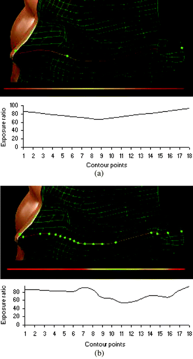 (a) Linearly interpolated exposure ratio map interpolated from three dosimeter measurements at positions CN1, CN9 and CN18 for the same horizontal contour plotted in Fig. 5(b). (b) Exposure ratio map represented across 18 dosimeter sites along a single horizontal contour connecting the nose, cheek and ear.