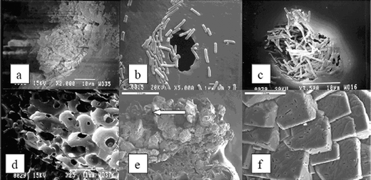 Scanning electron micrographs of calcite precipitation induced by B. pasteurii immobilized in PU. a. Porous PU matrix without microbial cells showing open-cell structures. Bar, 1 mm. b. Distribution of microorganisms on the PU surface. Bar, 1 μm. c. Microorganisms densely packed in a pore of the PU matrix. Bar, 10 μm. d. Calcite crystals grown in the pore (shown in c) of the PU matrix. Bar, 10 μm. e. Calcite crystals grown extensively over the PU polymer. Bar, 500 μm. f. Magnified section pointed with an arrow in e shows crystals embedded with microorganisms. Bar, 20 μm. Reproduced with permission from ref. 173.