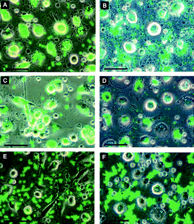 
            Phagocytosis of coated microcapsules: dendritic cells (left) and macrophages (right) were incubated with 4.8 μm (left) or 1.2 μm (right) microcapsules for 4 h. Images were obtained by an overlay of phase contrast and fluorescence channels. (A, B) PSS-coated microcapsules; (C, D) PLL-coated microcapsules; (E, F) PLL-g-PEG coated microcapsules. Scale bars = 50μm. Reprinted with permission from ref. 111. Copyright 2008, American Chemical Society.