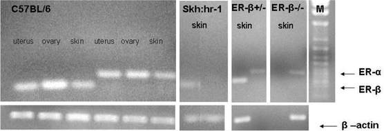 Expression of Er-α and Er-β mRNAs in extracts of uterus, ovary and dorsal skin from C57BL/6 mice, and in dorsal skin of Er-β+/–, Er-β–/– and hairless Skh:hr-1 mice. Housekeeping gene was β-actin. M = M.Wt. marker.