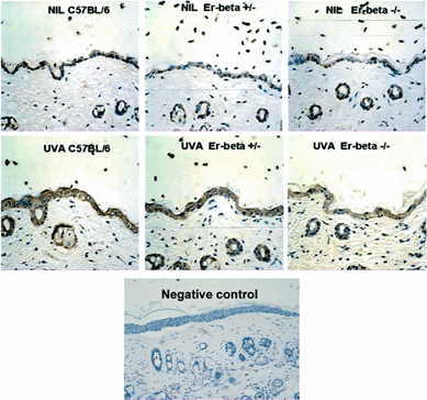 Immunohistochemical staining (brown) for IFN-γ in mid-dorsal skin sections of C57BL/6, Er-β+/– and Er-β–/– mice, before and at 24 h post-UVA irradiation. Primary antibody was omitted in negative control section.