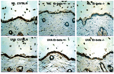 Immunohistochemical staining (brown) for IL-12 in mid-dorsal skin sections of C57BL/6, Er-β+/– and Er-β–/– mice, before and at 72 h post-UVA irradiation.