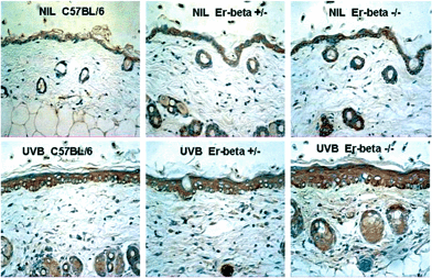 Immunohistochemical staining (brown) for IL-10 in mid-dorsal skin sections of C57BL/6, Er-β+/– and Er-β–/– mice, before and at 72 h post-UVB irradiation.