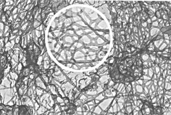 Physical gel. Cytoplasmic filamentous network in cultured ovarian granulosa cells. Reprinted with permission from Ref. 72.