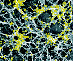 Physical gel. Electron micrograph of unroofed cells, immunogold labeled. The picture shows an overview of actin organization at the bottom surface of a cell. Reprinted with permission from Ref. 73.