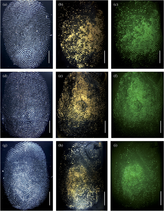Images (a, d, g) represent the brightfield images of 3 different fingermarks prior to incubation with the conjugates and secondary antibody fragments; (b, e, h) represent the brightfield images after application of the anti-cotinine magnetic particle conjugates and secondary antibody fragments; (c, f, i) represent the fluorescence images after incubation with the particles and secondary antibody fragments. The fingerprints were incubated with magnetic particles for 30 (b, c), 20 (e, f), and 10 (h, i) minutes. In this experiment, the excess particles were removed with a magnet. The scale bars = 5 mm.