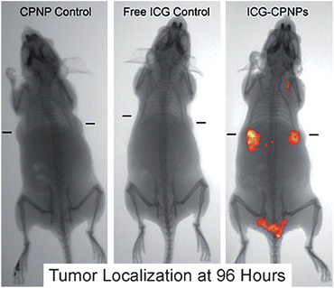 Biodistribution of indocyanine green labeled tumor-targeted nanoparticles, post-exposure for 96 hours using unlabeled calcium phosphate nanoparticles (CPNP control), free indocyanine green (Free ICG Control), or indocyanine green labeled nanoparticles (ICG-CPNPs). The implanted targeted tumor location is denoted by dash marks in each image. (Reprinted with permission from ref. 167. Copyright 2008, American Chemical Society.)