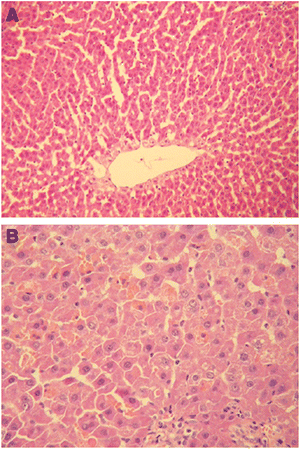 Histopathology images of rat liver tissue, using H & E staining, 6 days post-exposure where (A) control rats show normal tissue morphology and (B) scattered dot necrosis was seen in rats exposed to nano-copper at 200 mg/kg/d. (Reprinted with permission from ref. 172. Copyright 2008, Elsevier.)