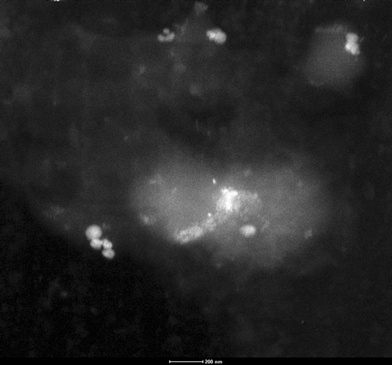 
              Dark-field TEM image of catalyst 1 after the third reaction cycle.