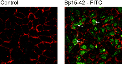 Human umbilical vein endothelial cells; control staining for cell borders in red and incubation with Bß15–42-FITC (green). Arrows denote examples for Bß15–42 in the cells cytoplasm.