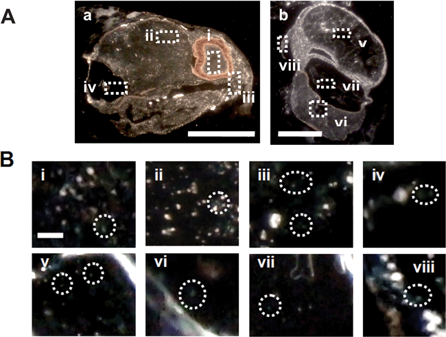 Characterization of Au nanoparticles embedded in a fully developed zebrafish. (A) Optical color images of a fixed (a) longitudinal section and (b) cross-section of a normally developed zebrafish. The rectangles highlight representative areas: (i) retina, (ii) brain tissue, (iii) nasal sensory epithelium, (iv) otic capsule, (v) stomach, (vi) notochord, (vii) swim bladder, and (viii) pectoral fin. Thickness of tissue sections = 3.5 ± 0.5 µm. (B) Zoomed-in optical images of those tissue sections outlined in (A). The circles highlight representative individual Au nanoparticles embedded in the tissue sections. Scale bar = 200 µm in (A) and 4 µm in (B). LSPR spectra of individual embedded nanoparticles are similar to those observed in Fig. 2C, showing that they are indeed Au nanoparticles and the majority of embedded nanoparticles remain non-aggregated.