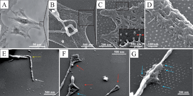 (A) A phase-contrast micrograph of a fixed REF52 cell plated for 24 h on extended patterned interfaces including 6 nm-sized gold nanoparticles with lateral spacings of ∼58 nm. (B)–(D) Scanning electron micrographs show parts of cells on such biofunctionalized extended nanopatterns. The inset in (C) shows a close-up view of ultra-small cellular protrusions with diameters of 10–20 nm, and lengths of 30–50 nm, interacting with the activated gold nanoparticles. (D) SEM image, recorded with a tilt angle of 40°, depicting ultra-small cellular protrusions interacting with the c(-RGDfk-) adhesion sites. (E)–(G) Scanning electron micrographs of filopodial structures on biofunctionalized hierarchical nanopatterns (500 nm squares separated by 1000 nm, tilt angle 45°). The white arrow indicates an early filopodial structure, including its bending (indicated by the yellow arrow), red arrows indicate mature contact structures, and blue arrows show ultra-small cellular protrusions in contact with the adhesive gold nanoparticles.