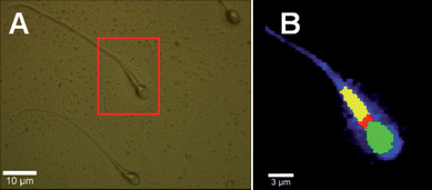 Panel A shows a bright-field optical image of human sperm cells with a scale bar of 10 µm. Panel B shows the chemical map constructed from Raman measurements taken on a single cell within the red square as indicated in panel A. The chemical image is based upon method 2 (see text); a k-means cluster analysis from 400–3400 cm−1. The nucleus (green), neck (red) and the middle piece (yellow) can unambiguously be identified. The blue colour scale corresponds to the integrated intensity of the C–H stretching vibration (2850–3000 cm−1).