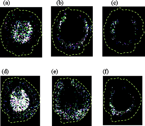IMS images generated from rat renal samples from the control (a–c) and MC3 (d–f) groups with detected at (a, d) m/z 798 (PC34:1 + K), (b, e) m/z 820 (PC 36 : 4 + K), and (c, f) m/z 741 (SM 16 : 0 + K).