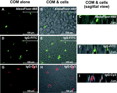 
          The internalization of fluorescent COM crystals into MDCK cells. After MDCKcells were incubated with fluorescent COM crystals (100 µg crystals per mL of culture medium) for 48 h, the non-adherent crystals were removed by vigorous washing with PBS three times, whereas the adherent crystals were finally detached and/or dissolved with trypsin/EDTA solution. (A, D and G): Fluorescent COM crystals without cells. (B, E and H): Internalized crystals (remaining crystals after removal of non-adherent and adherent (extracellular) crystals). (C, F and I): The internalized crystals are clearly illustrated with sagittal view of confocal sections. All panels were taken from a laser-scanning confocal microscope equipped with LSM5 Image Browser (LSM 510 META, Carl Zeiss; Oberkochen, Germany).